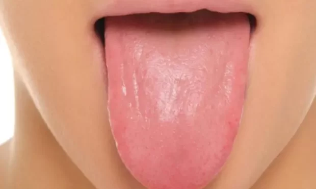 علت اصلی قهوه ای شدن زبان