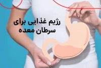 نکات طلایی در مورد رژیم غذایی برای سرطان معده نکات طلایی در مورد رژیم غذایی برای سرطان معده