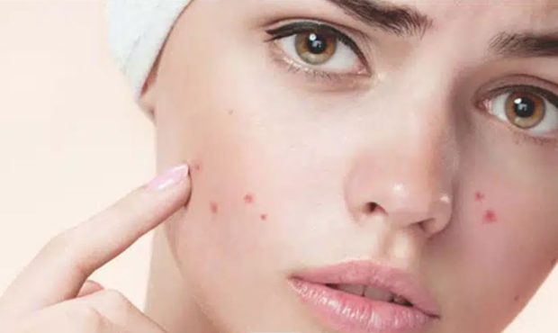 نازک شدن مو چه دلیلی دارد؟ با این راه‌کارها آن را درمان کنید