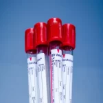 آزمایش CA-125 یا آنتی ژن سرطانی