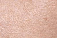 ساده ترین و بهترین روش مراقبت از پوست خشک صورت و بدن