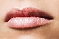 ترک گوشه لب نشانه چیست؟