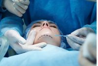 تفاوت ژل چانه و پروتز چانه چیست؟ تفاوت ژل چانه و پروتز چانه چیست؟