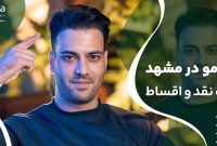 چرا کاشت مو در مشهد محبوب است؟