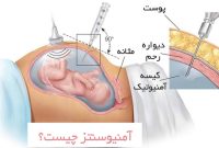 آزمایش های دوران بارداری