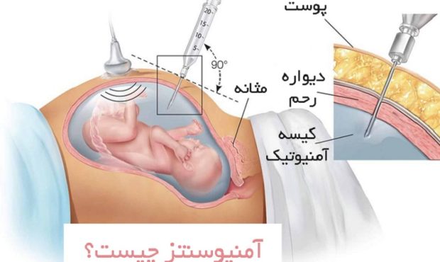 آزمایش های دوران بارداری