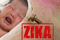 تاثیر ویروس زیکا در بارداری بر سیستم ایمنی کودک تاثیر ویروس زیکا در بارداری بر سیستم ایمنی کودک