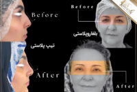معرفی لیست خدمات زیبایی دکتر ایرانچی