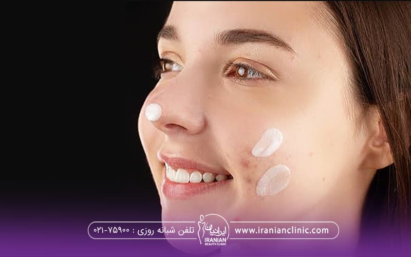 فردی که روی صورت خود چند نقطه کرم زده است