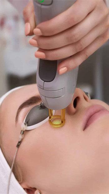 کربوکسی تراپی یک روش کم خطر برای جوان سازی پوست