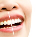 آیا بلیچینگ دندان پر شده مؤثر است؟ بررسی علمی و تجربی