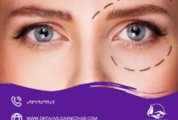 تغذیه بعد از بلفاروپلاستی: راهنمای جامع