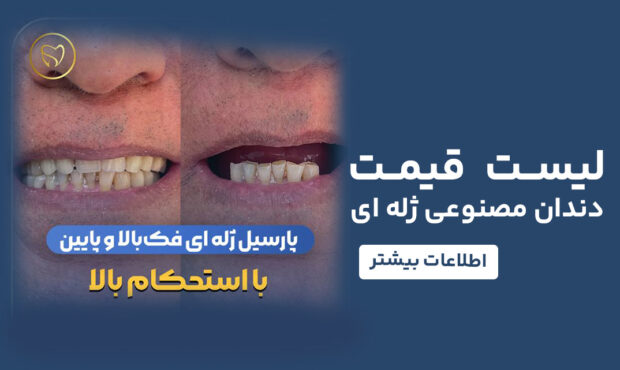 لیست قیمت دندان مصنوعی ژله ای