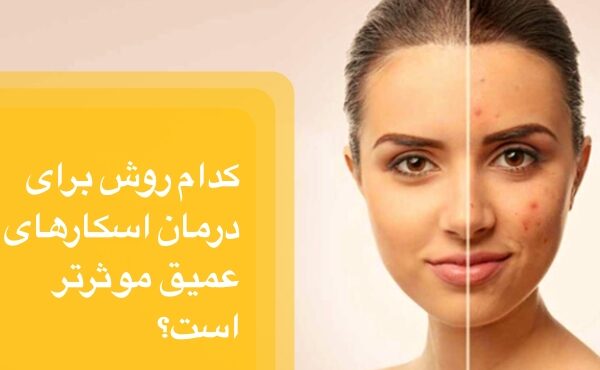 تصویر کدام روش برای درمان اسکار موثر است