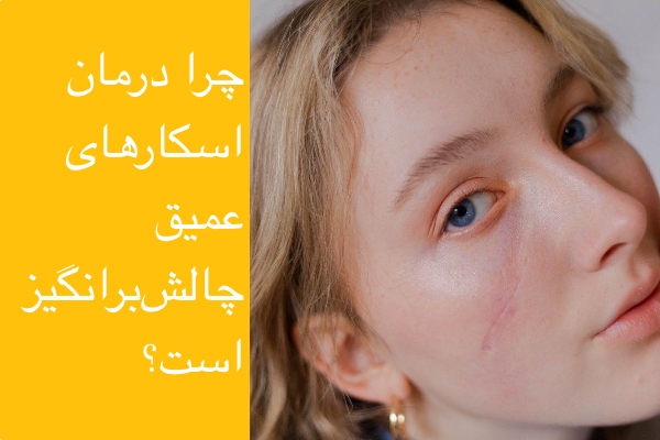 تصویر چرا درمان اسکار عمیق چالش برانگیز است