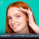 روش های از بین بردن لک صورت در خانه