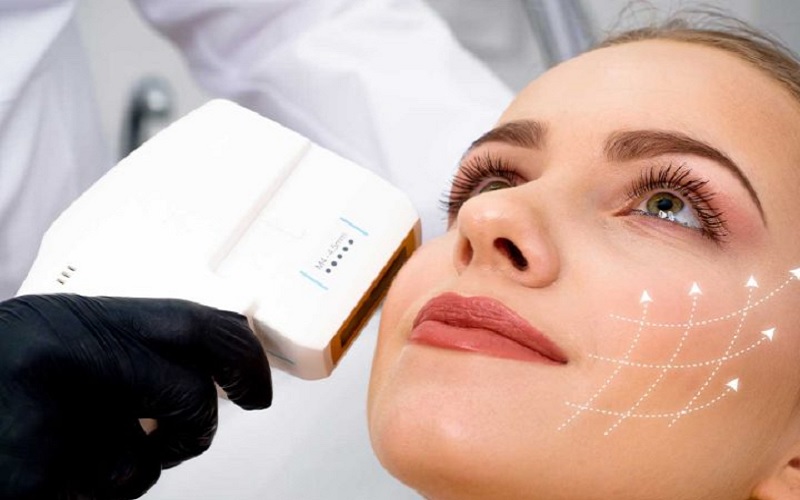 هایفوتراپی صورت چیست و چگونه انجام میشود؟ هایفو صورت در اصفهان