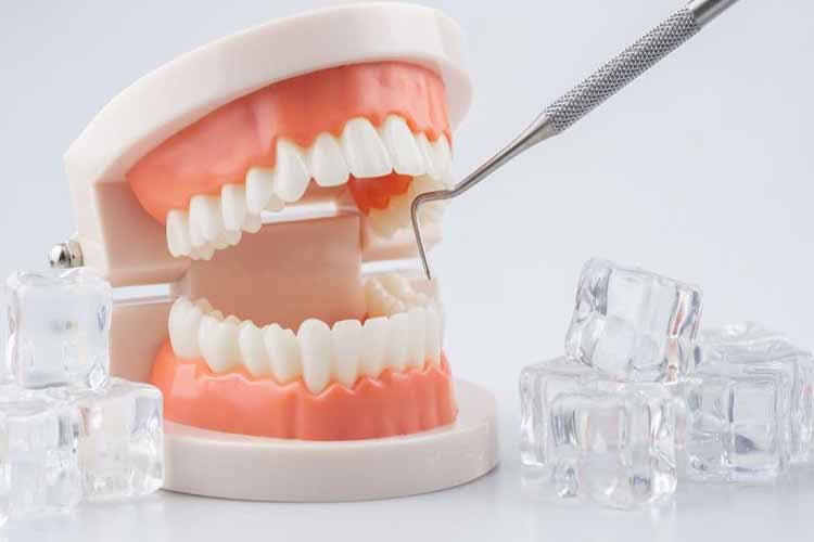 جرم گیری دندان چیست و چرا هر ۶ ماه یکبار باید انجام شود؟ جرم دندان