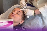 چرا بوتاکس دیگر فقط مخصوص افراد بالای ۴۰ سال نیست؟