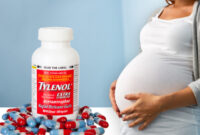 ارتباط مصرف استامینوفن در دوران بارداری و خطر ابتلا به اوتیسم؛ بررسی شواهد علمی و چالش‌ها