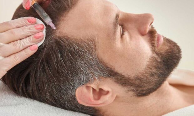 توقف ریزش موی ارثی ؛ کدام کوکتل مزوتراپی برای شما ساخته شده است؟