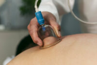 حجامت؛ روش طبیعی و مؤثر برای درمان جوش‌های صورت و مشکلات هورمونی