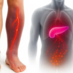 هشدار؛ اگر پاهایتان این ۴ علامت را دارد، ممکن است سرطان پانکراس باشد!_692d554f6e62a.jpeg