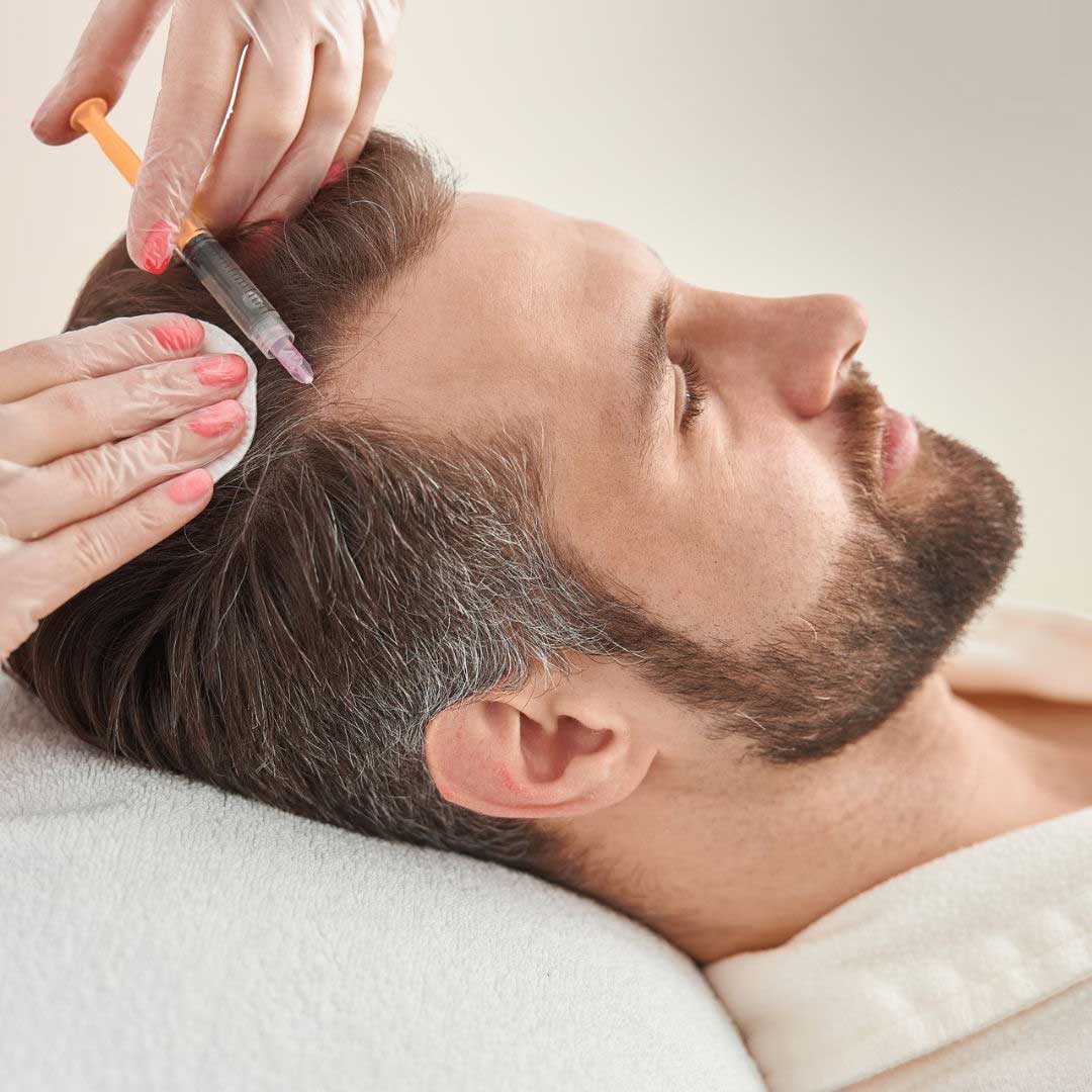 کوکتل مزو تراپی ریزش ارثی