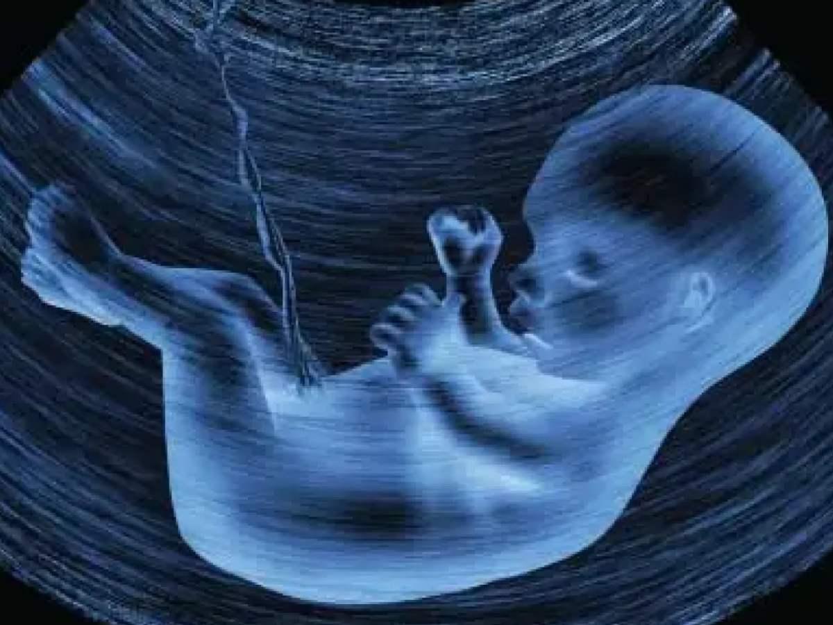 لیست کامل سونوگرافی‌های بارداری؛ از هفته اول تا زایمان
