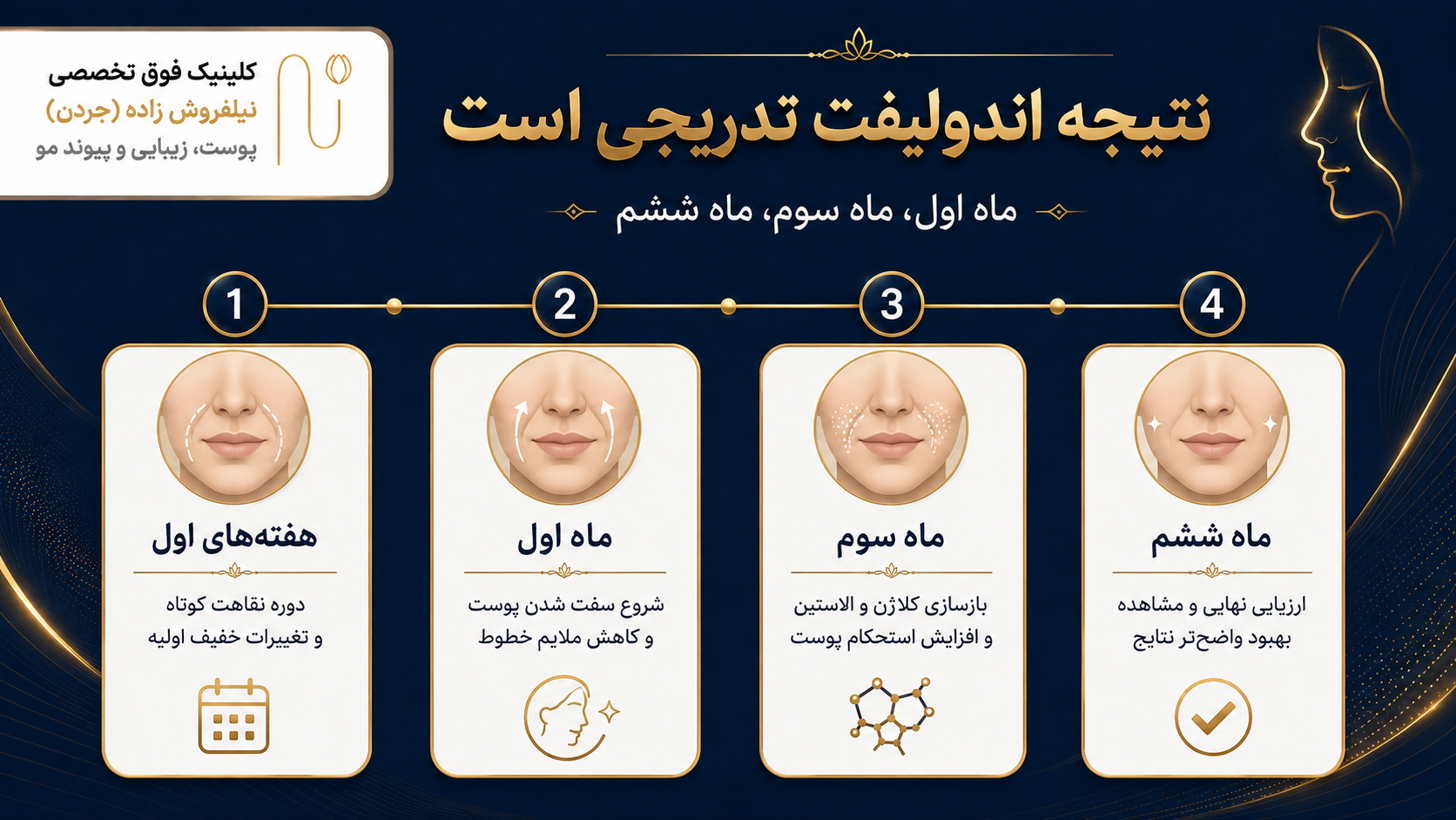 اندولیفت برای خط خنده موثر است؟ نتیجه اندولیفت