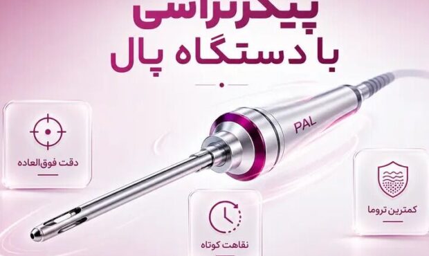 پیکرتراشی با دستگاه پال (PAL) چیست؟ بررسی مزایا، هزینه و تفاوت با لیپوماتیک