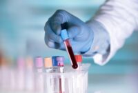 خطر HPV کاملا جدی است؛ نگرانی یک ویروس شناس
